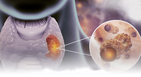 Doctor for Thyroid Problems Treatment in Mulund